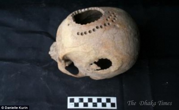 1000-year-old-Skull