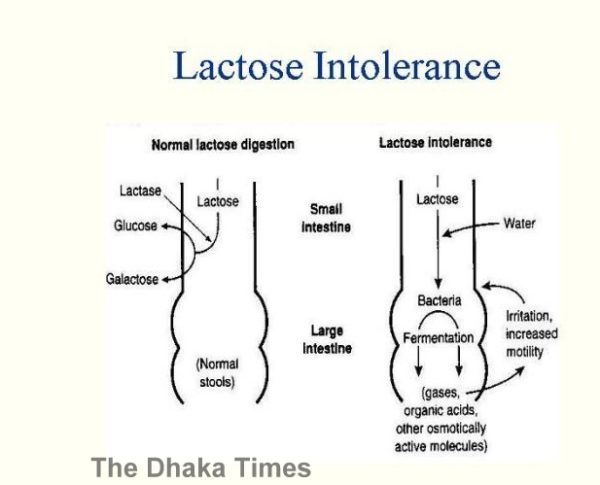 lactose_intolerance_diagram