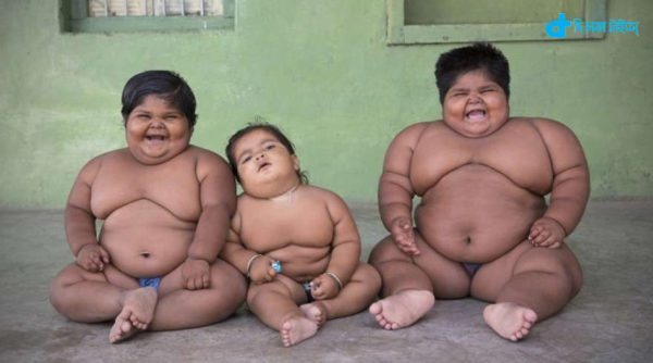 children of obese-3