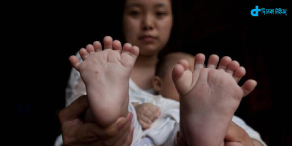 A child's hand-toes 31