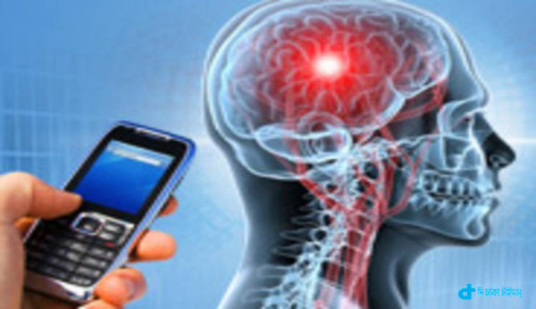 Smartphones brain tumor may be