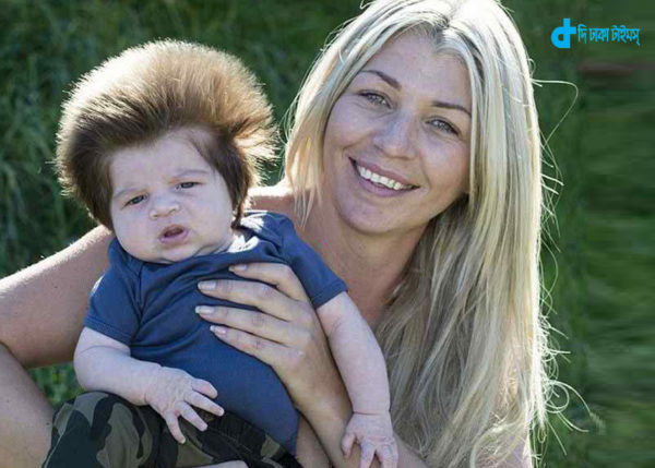 two-month-old-baby-came-to-a-full-head-of-hair