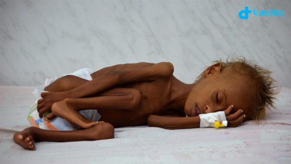 child-yemen