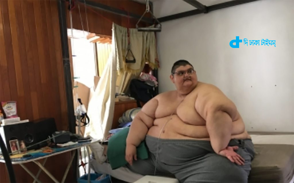 Самый тяжелый человеческий. Хуан Педро самый толстый.