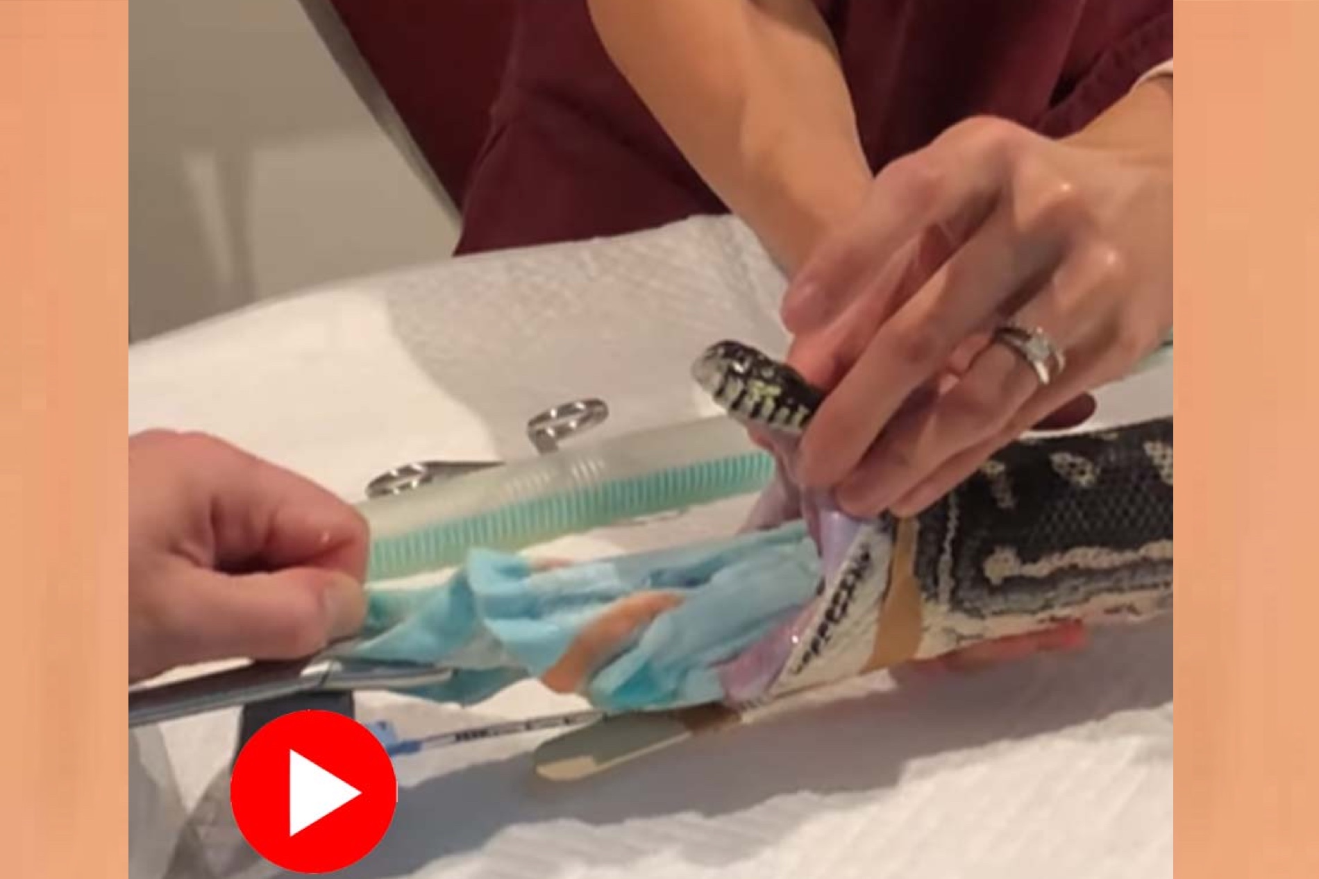 খিদের চোটে মাঝরাতে আস্ত তোয়ালে গিলে ফেললো অজগর! 10