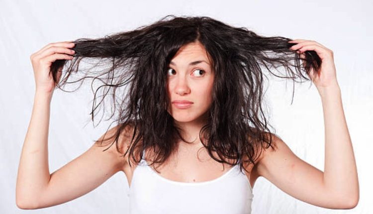 মাথার ত্বকের তৈলাক্ত ভাব দূর করতে ঘরোয়া টোটকা ব্যবহার করতে পারেন 1 মাথার ত্বকের তৈলাক্ত ভাব দূর করতে ঘরোয়া টোটকা ব্যবহার করতে পারেন 1