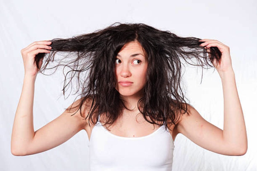 মাথার ত্বকের তৈলাক্ত ভাব দূর করতে ঘরোয়া টোটকা ব্যবহার করতে পারেন 1