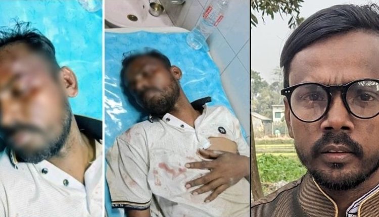 রাজধানীতে হিরো আলমের ওপর হামলা: হাসপাতালে ভর্তি 1 রাজধানীতে হিরো আলমের ওপর হামলা: হাসপাতালে ভর্তি 1