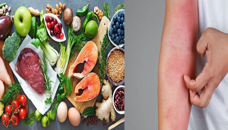 কোন খাবারগুলোর কারণে এলার্জিজনিত সমস্যা হতে পারে 1