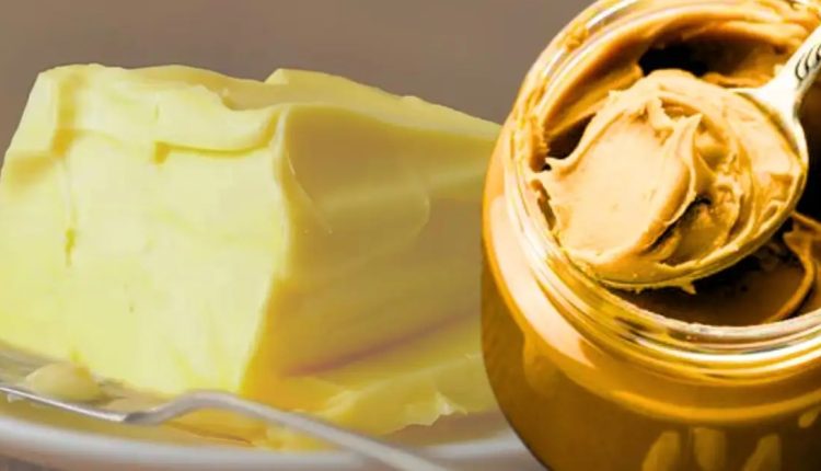 মাখনের পরিবর্তে পিনাট বাটার খেলে কী কোলেস্টেরল কমবে? 2