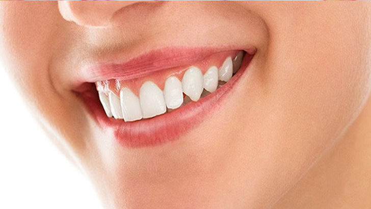 দাঁতের যত্ন নিতে যা করবেন 1 দাঁতের যত্ন নিতে যা করবেন 1