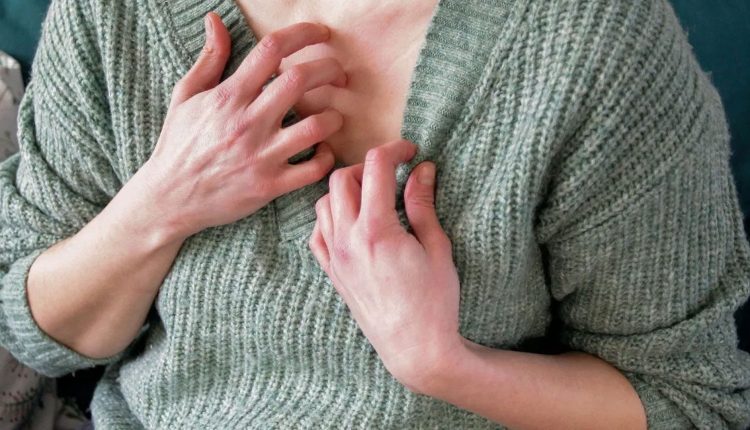 উলের পোশাক পরে অ্যালার্জি হলে যা করবেন 1